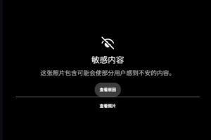 露骨！慎入！范德彪小拇指的骨头直接刺出来了！配图